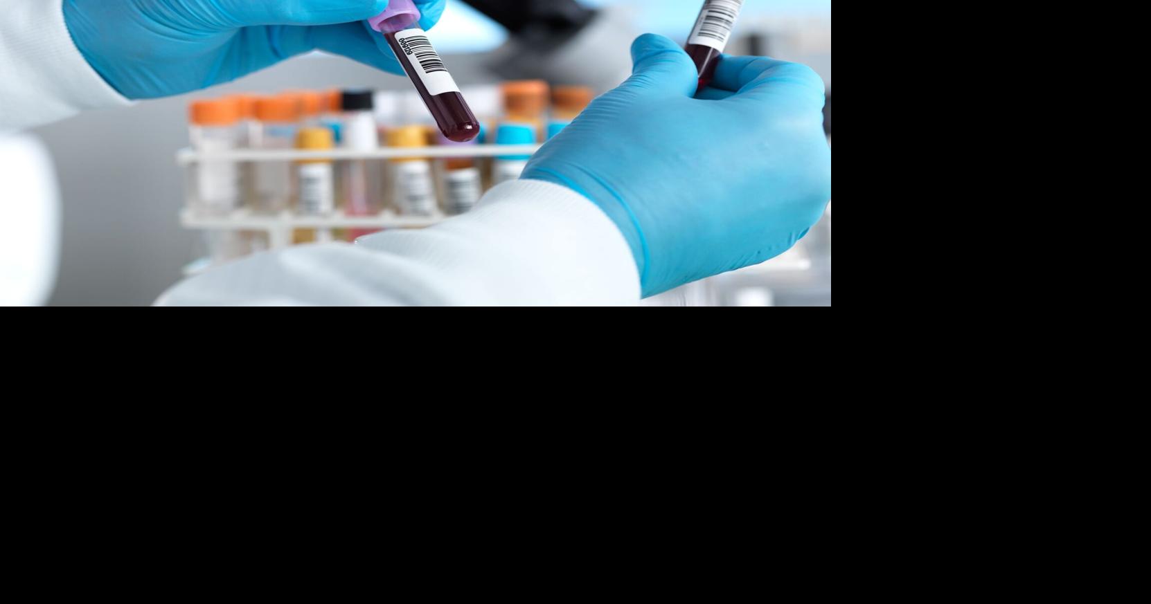 Carbon dioxide levels are higher than humans have ever experienced. It could be changing our blood chemistry