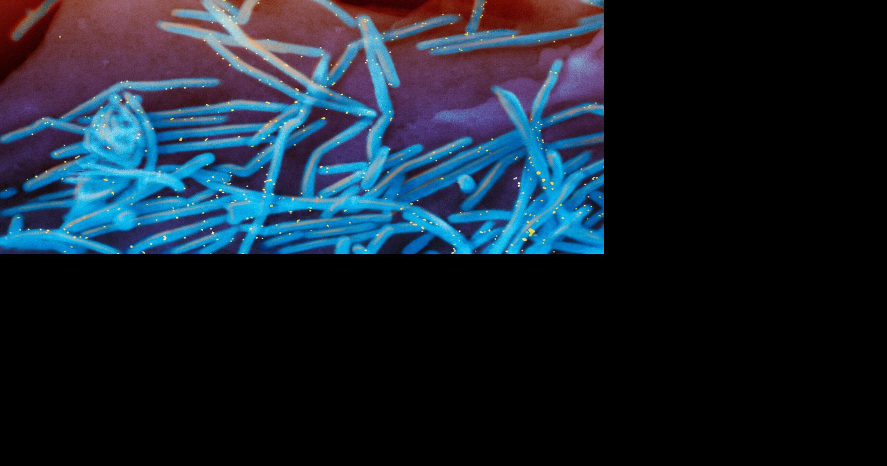 Winter virus season so far is not too bad despite concerns | Hot off the Wire podcast