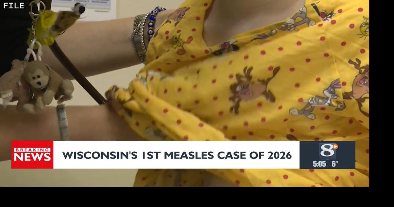 Wisconsin sees first measles case of 2026