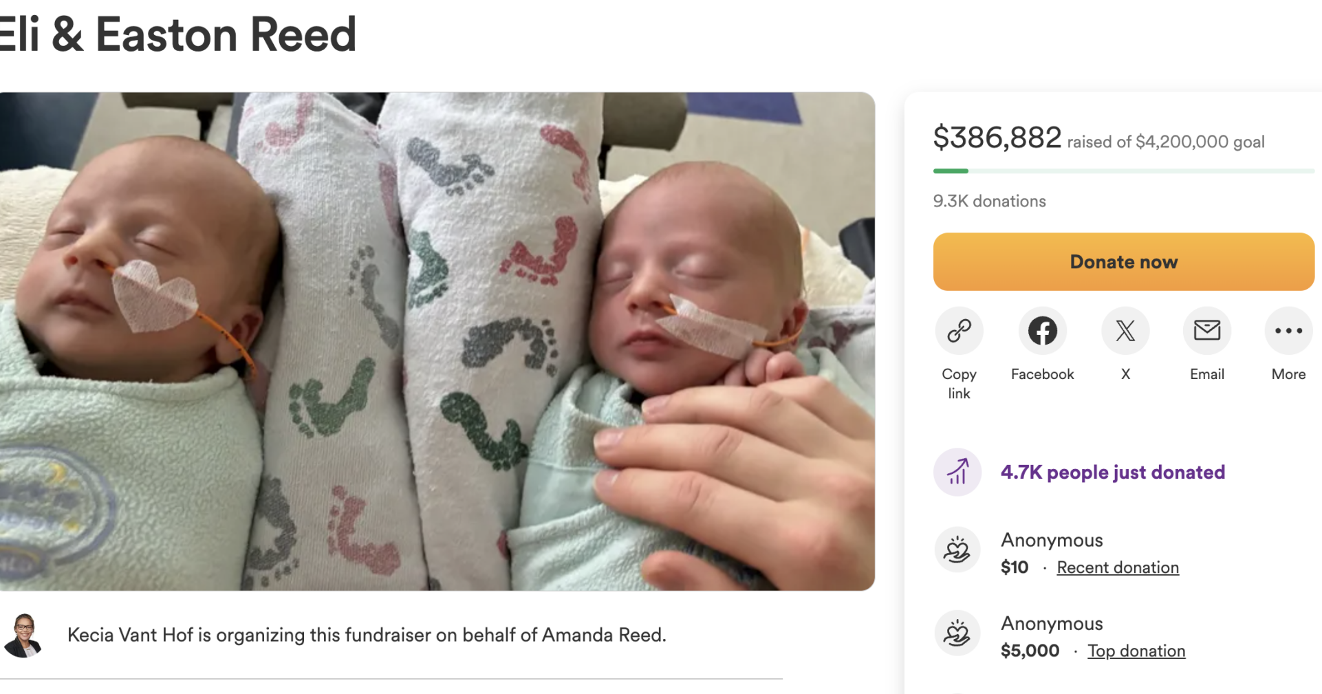Local parents of twins with medical condition 'feeling more confident' - Vimarsana News