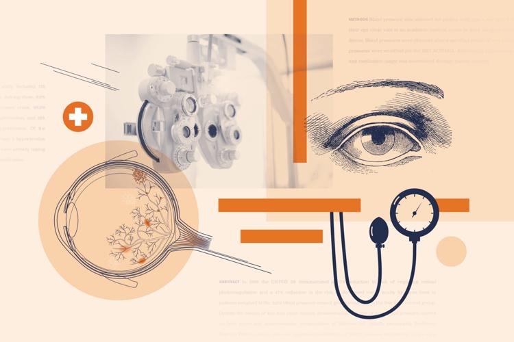 QandA: Could your eye exam save more than your sight?