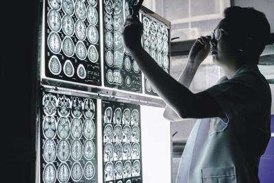 Having migraines raises the risk of dementia, one study finds
