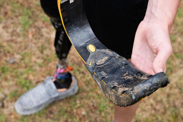 Student lost his leg in an accident; now he’s raising money for kids ...