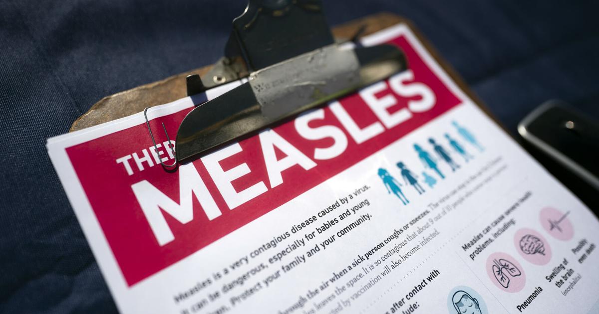 Photo : nny360.com Lewis County reports 10 additional measles cases, all in unvaccinated residents