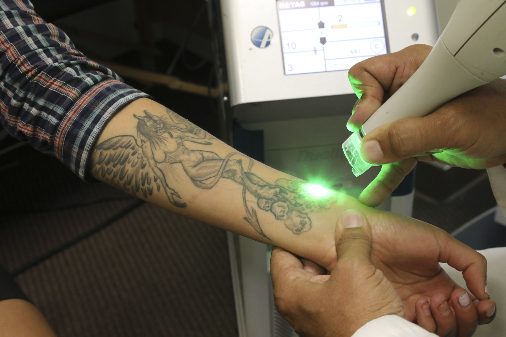 Metro Gang Unit asking Legislature for money to buy tattoo removal machine