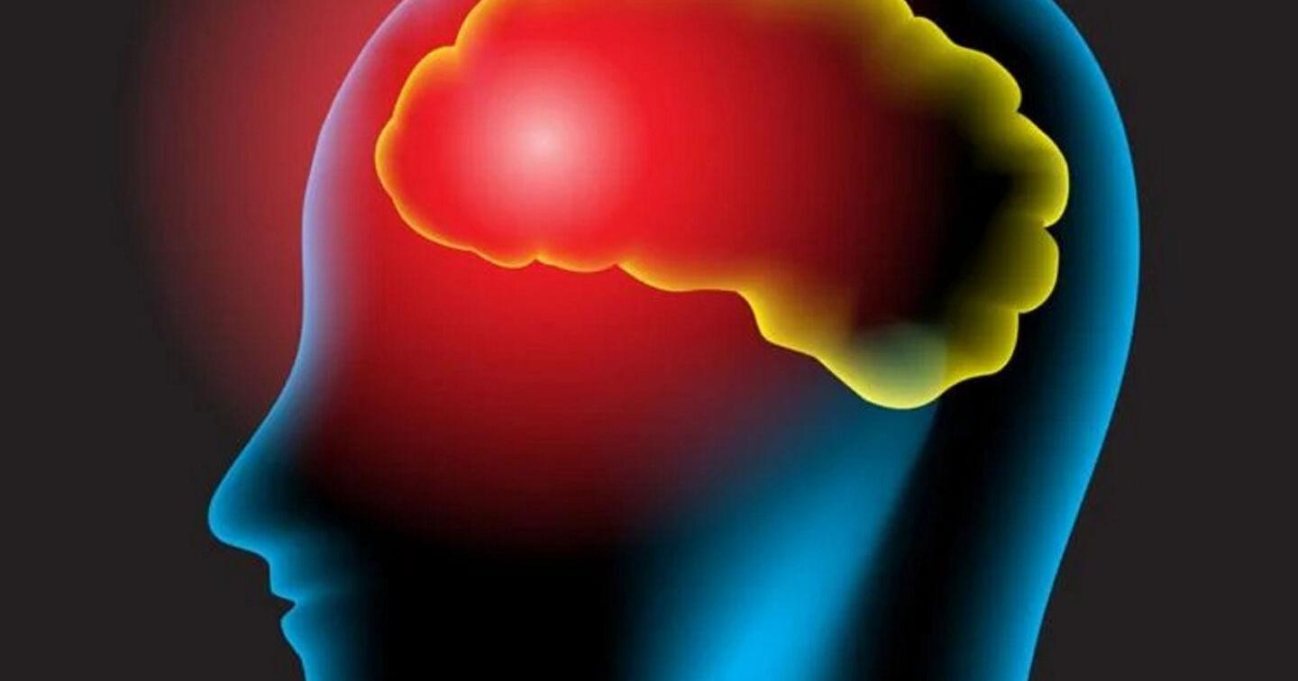Concussion awareness seminar Tuesday at Potsdam High School - Vimarsana News