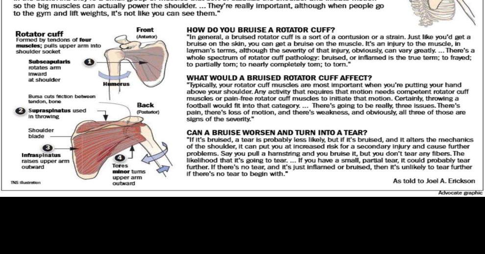 Report Saints quarterback Drew Brees battles rotator cuff bruise, what's it all mean? Saints