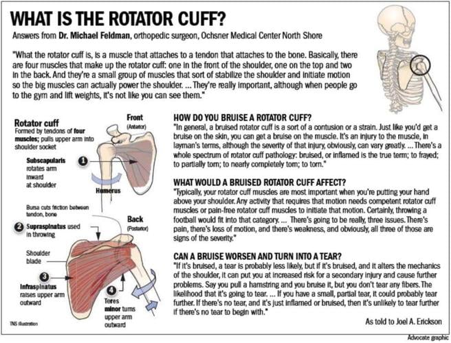 Report Saints quarterback Drew Brees battles rotator cuff bruise, what's it all mean? Saints