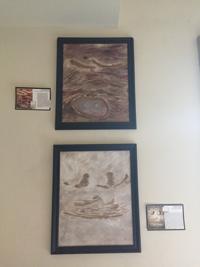 Cancer Survivors Paint Scar Art On Road To Recovery Archive