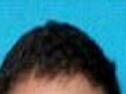 Records Man Fatally Choked By Avoyelles Deputies Had Long History Of Mental Illness Nola Com