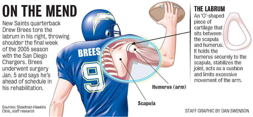 Live - Quarterback Drew Brees- Copper Compression Posture
