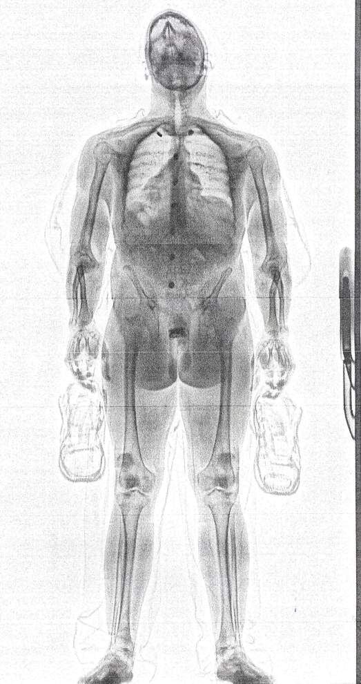 X-ray Body scanner for jail, prison – LINEV Systems