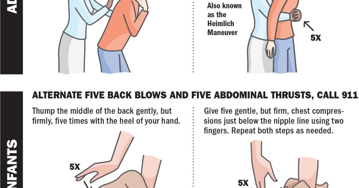 Saving lives with the Heimlich maneuver: how and when to do it ...