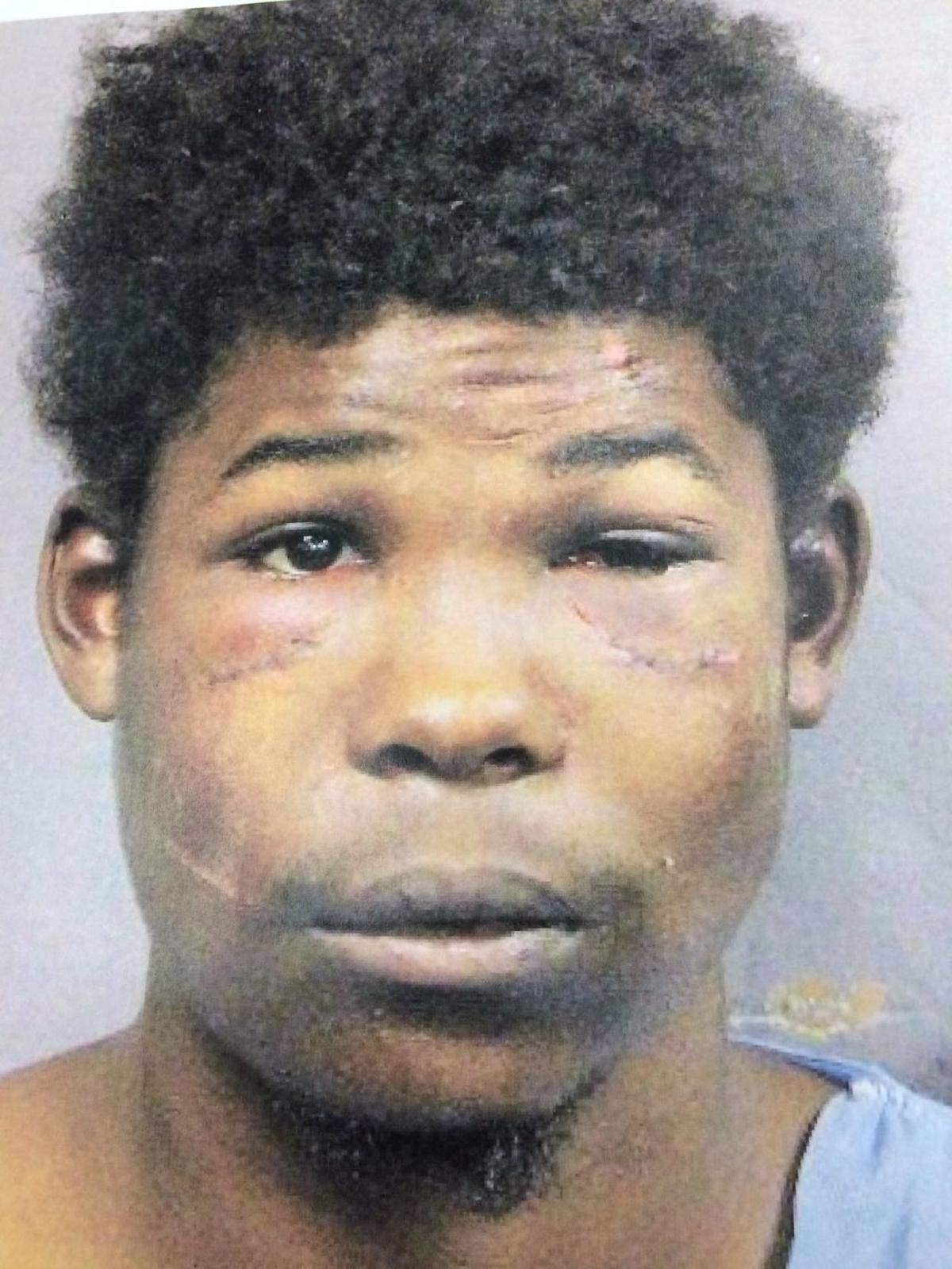 Judge delays doctorordered tests, treatment for accused cop killer