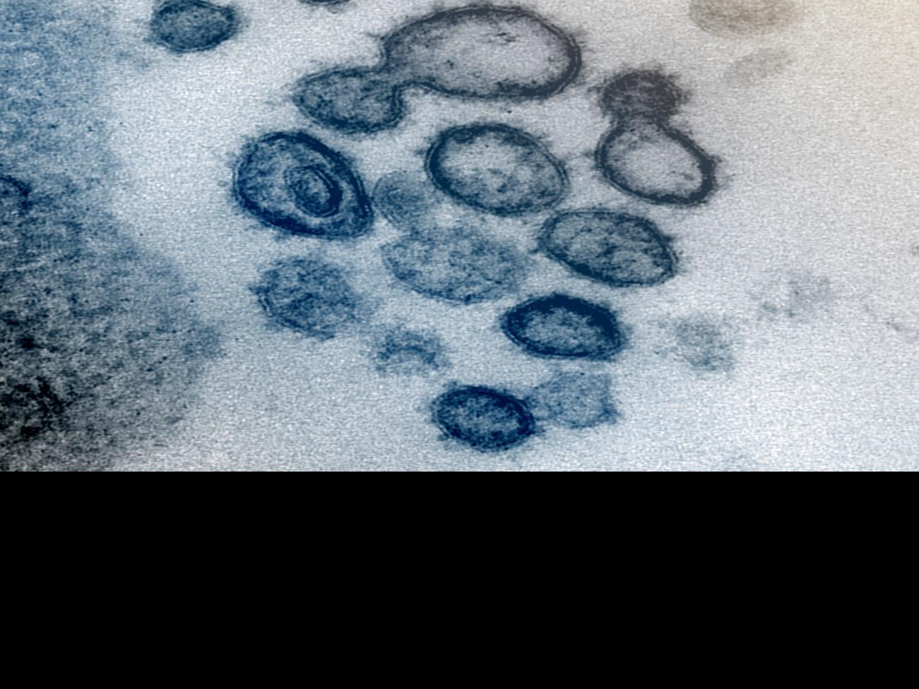 How Did Coronavirus Get To New Orleans Scientists Scrutinize Virus Genome For Answers Coronavirus Nola Com