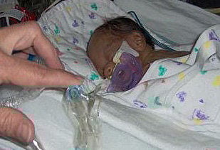 He was a tiny Katrina survivor. Now 10, he reunites with the doctor who