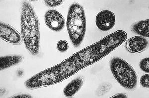Legionnaires’ disease making people sick on New York’s Upper East Side