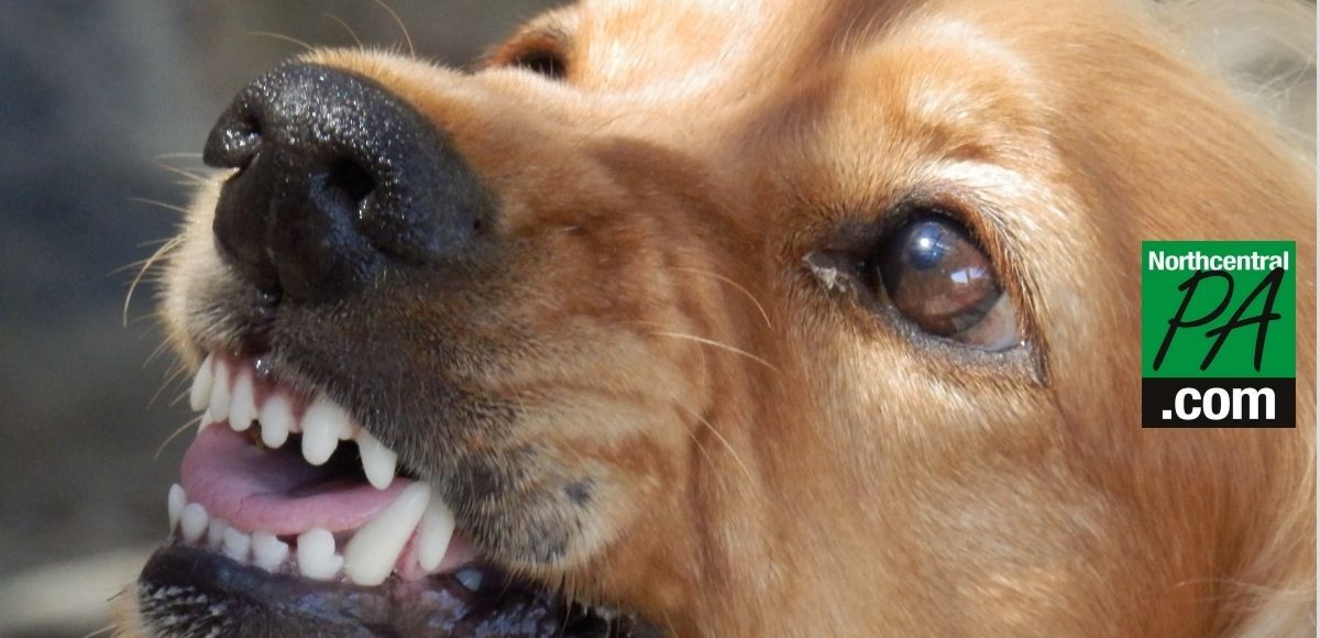 dog bite treatment in home