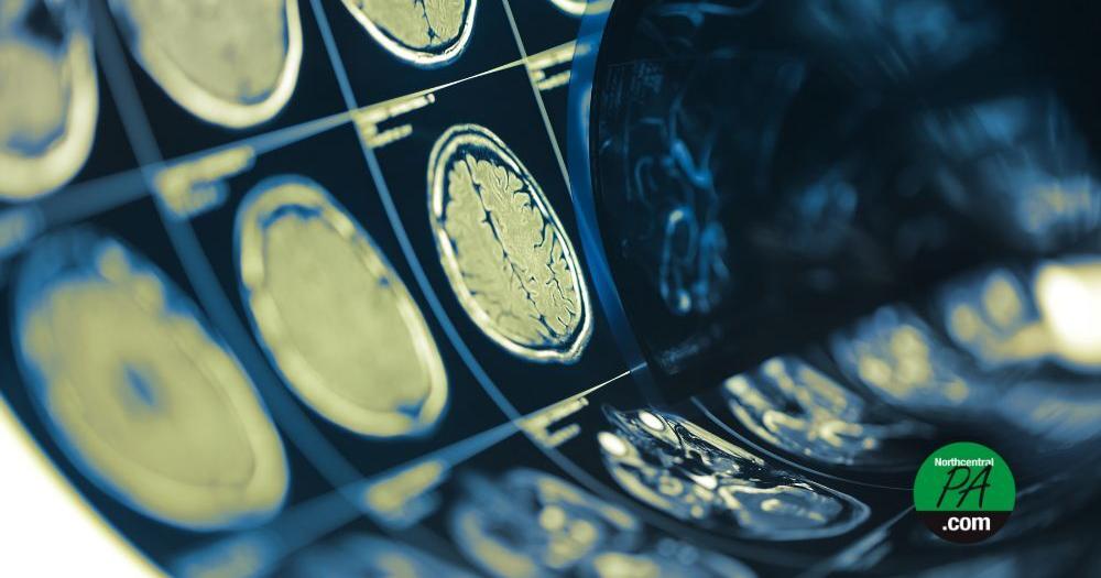 Pandemic ‘aged our brains’ even if you never got COVID-19 | Health ...