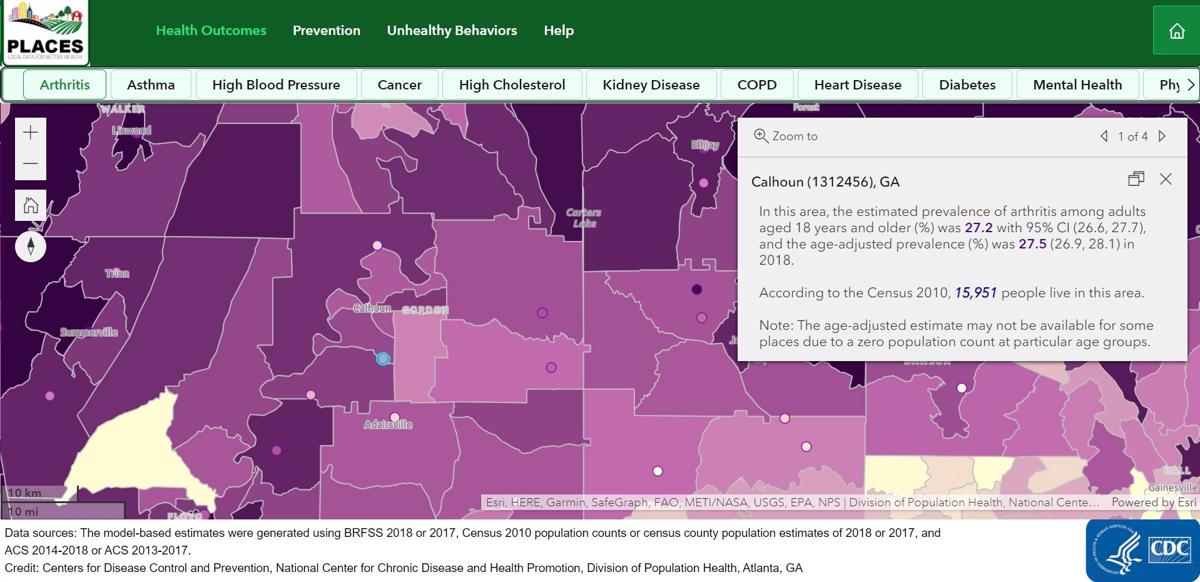 Cdc Launches Local Level Health Tracking Tool Floyd Ranks High On Sleeplessness Obesity Local News Northwestgeorgianews Com