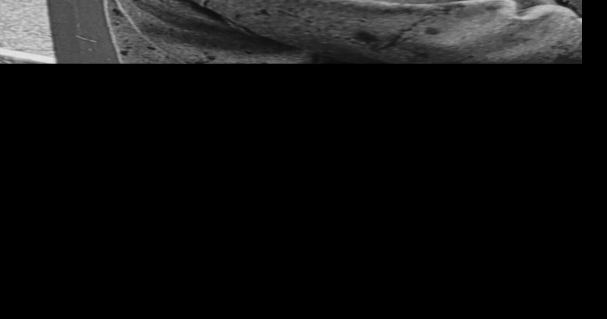 Christy Lynn Meyer Norton Obits