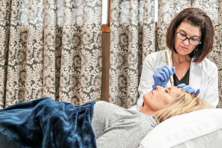 Fresh Face - Medical Microneedling