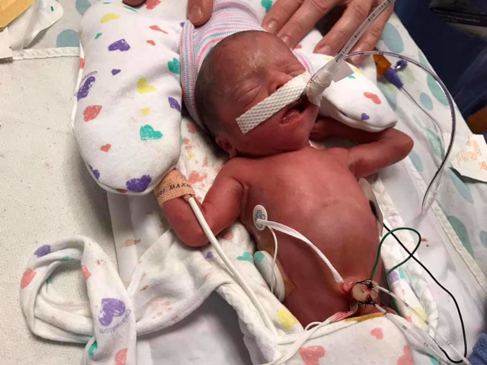 preemie baby girl