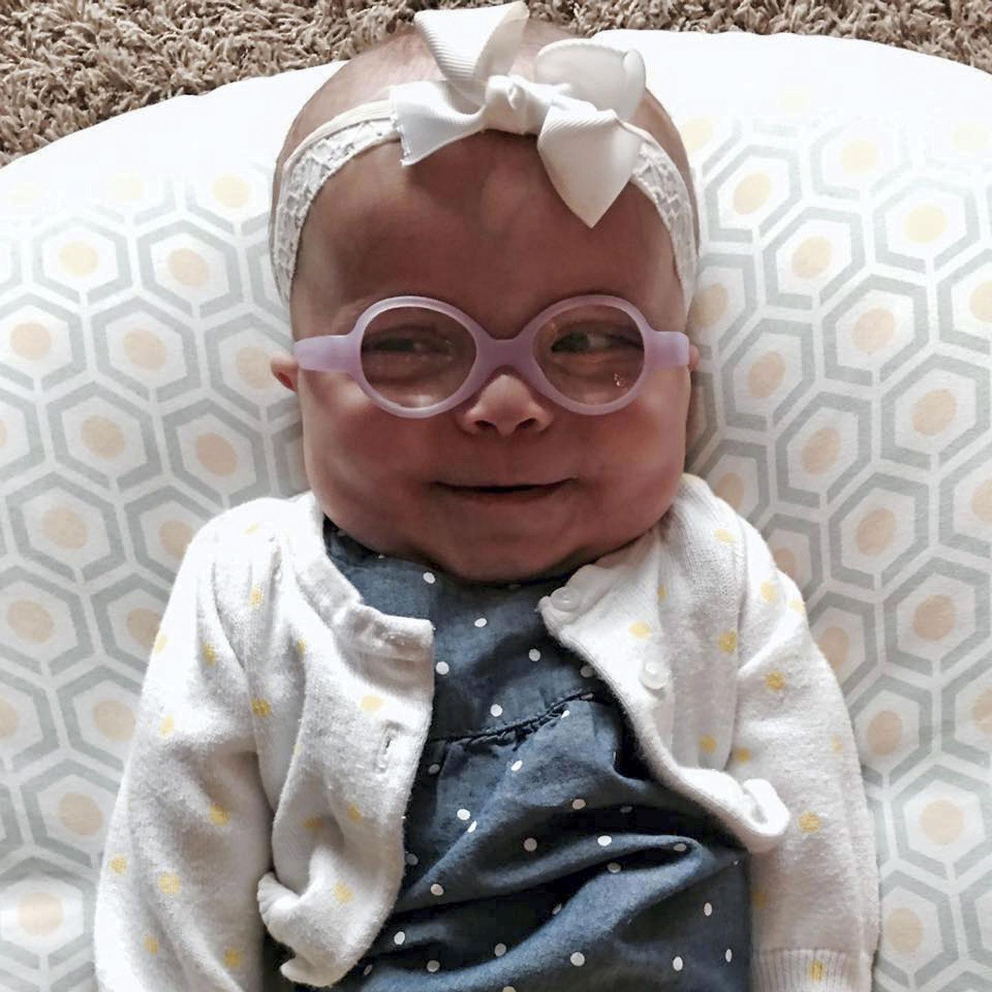 Fundraiser Will Celebrate 1st Birthday Of Papillion Girl With