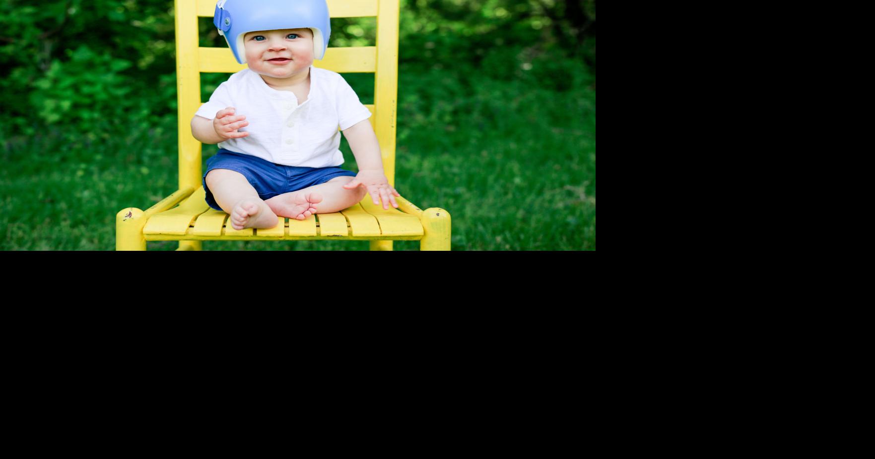 Does your baby need a helmet? Here are 3 tips to keep in mind.