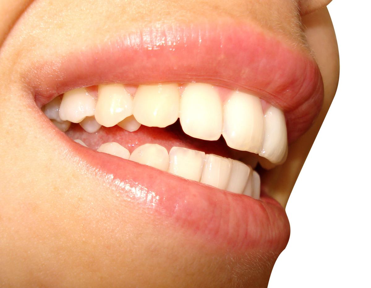 Local Dentist To Offer Free Dental Care Day United Way Looking For Volunteers And Other Charitable Events Local News Omaha Com