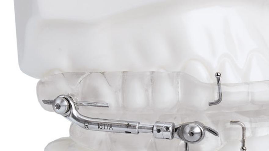Cpap Alternative Controls Sleep Apnea Curbs Risk Of Coronavirus Spread Sponsored Features Omaha Com