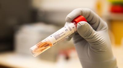 douglas county reports 8 new covid 19 cases lancaster lancaster county live incident report