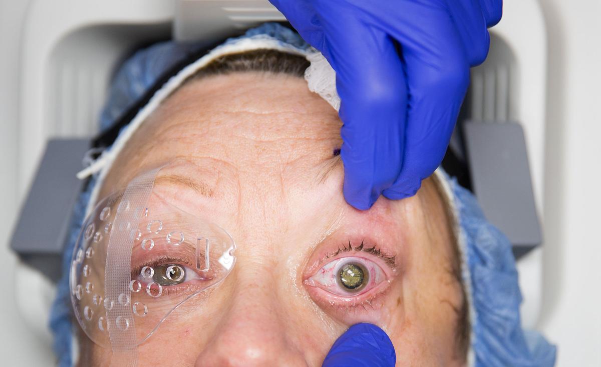 New type of lens implant adds an ‘exciting’ twist to the business of