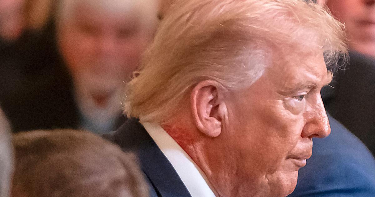 Das Weiße Haus erklärt, die Rötung an Trumps Hals stamme von einer ...