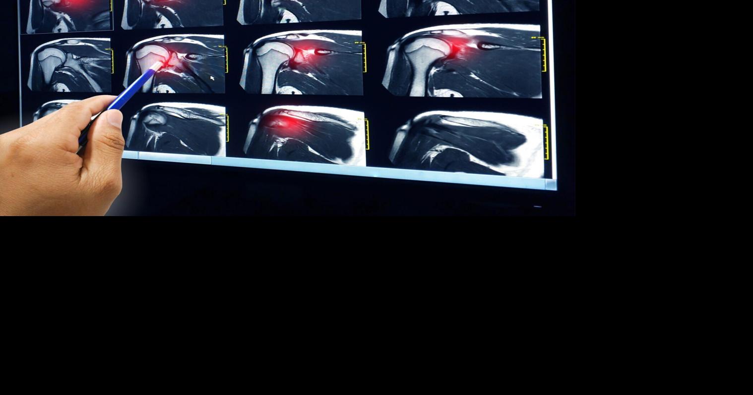 Learn how rotator cuff tears occur at February's Lunch & Learn seminar in Columbus