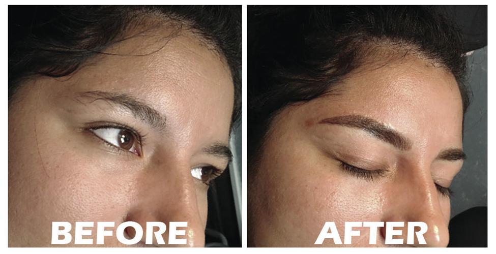 Before and After