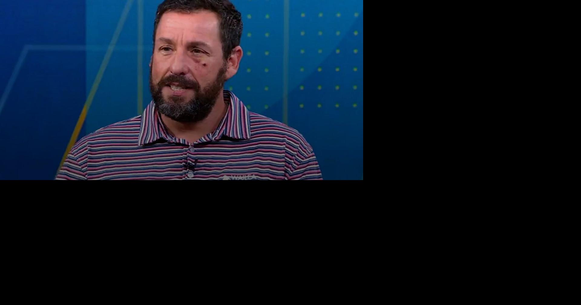 Adam Sandler explains how 'bad accident' led to black eye