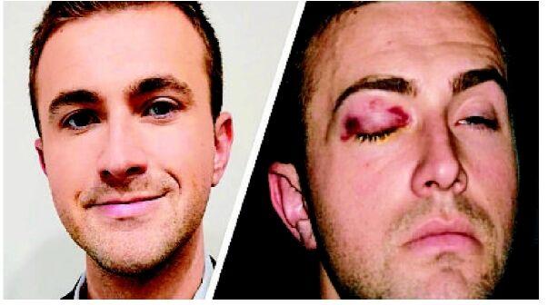 Man injured by pepperball May 29 files claim