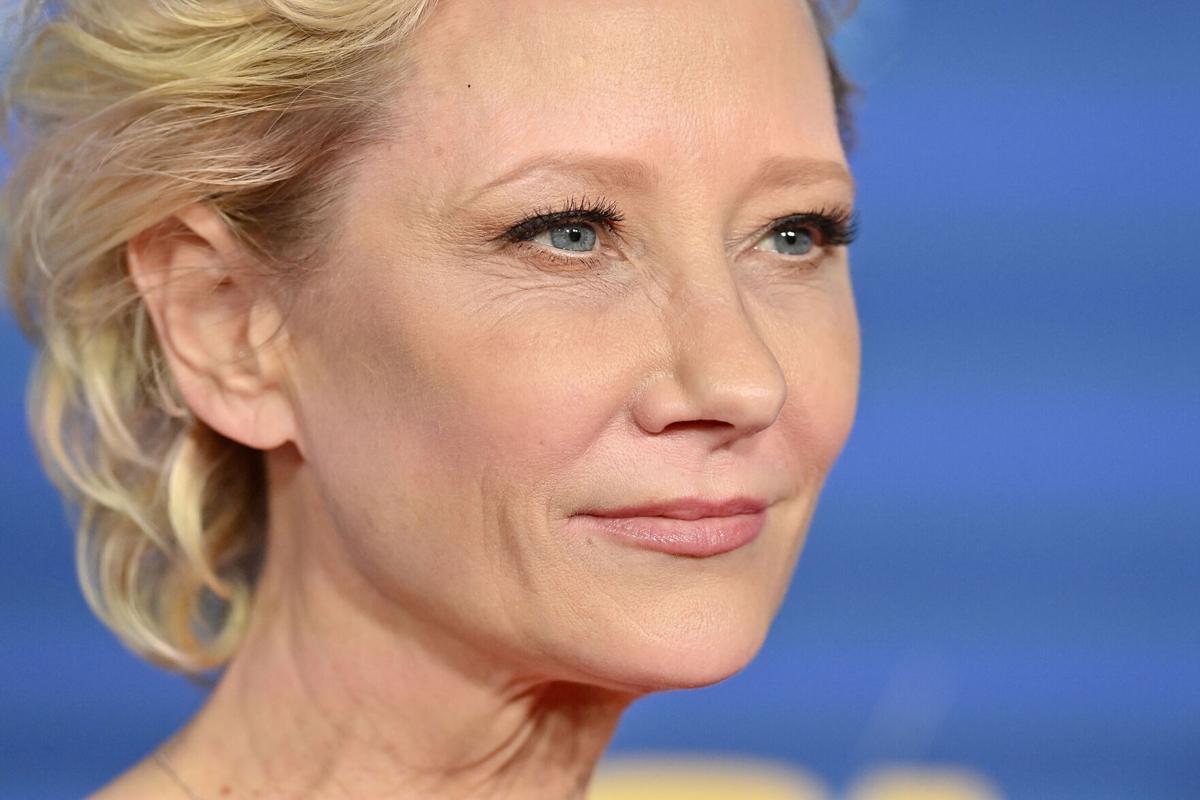 After a car accident, actress Anne Heche will have a "long recuperation."