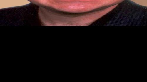 Tom Purcell: Fingers crossed on Social Security so I can ...