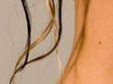 4 Ways To Make Stretch Marks Less Noticeable Momaha Omaha Com