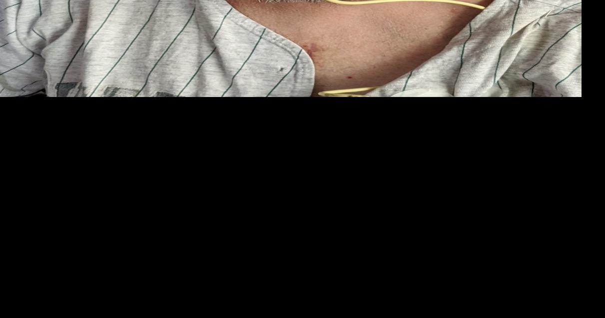 Nebraska Medical Center performs 400th heart transplant