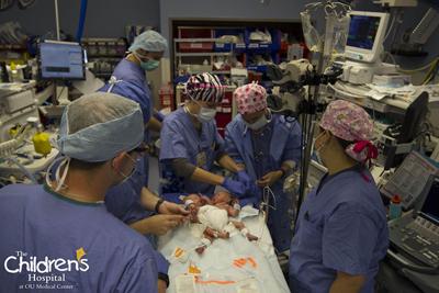 Ou Medical Center Separates Two Day Old Conjoined Twins News Oudaily Com