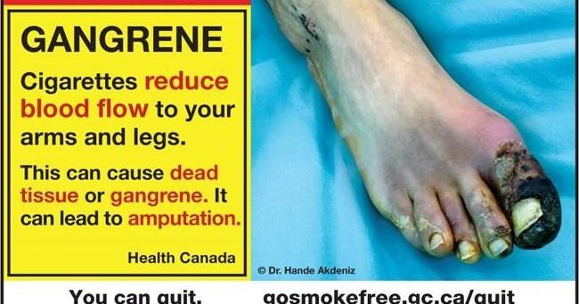 New graphic health warnings on cigarette packs aim to help smokers kick the habit - Vimarsana News