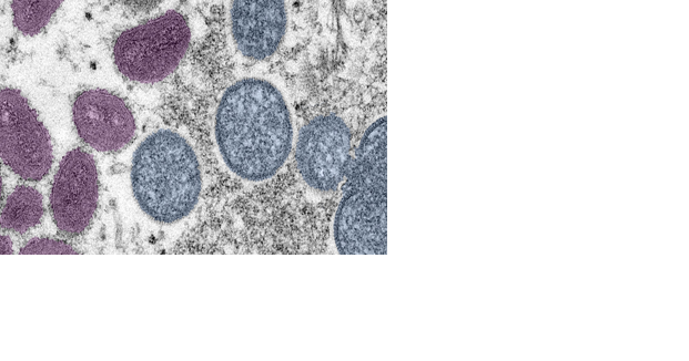 Mpox Virus: OHA urges vaccinations after rise in cases - Vimarsana News
