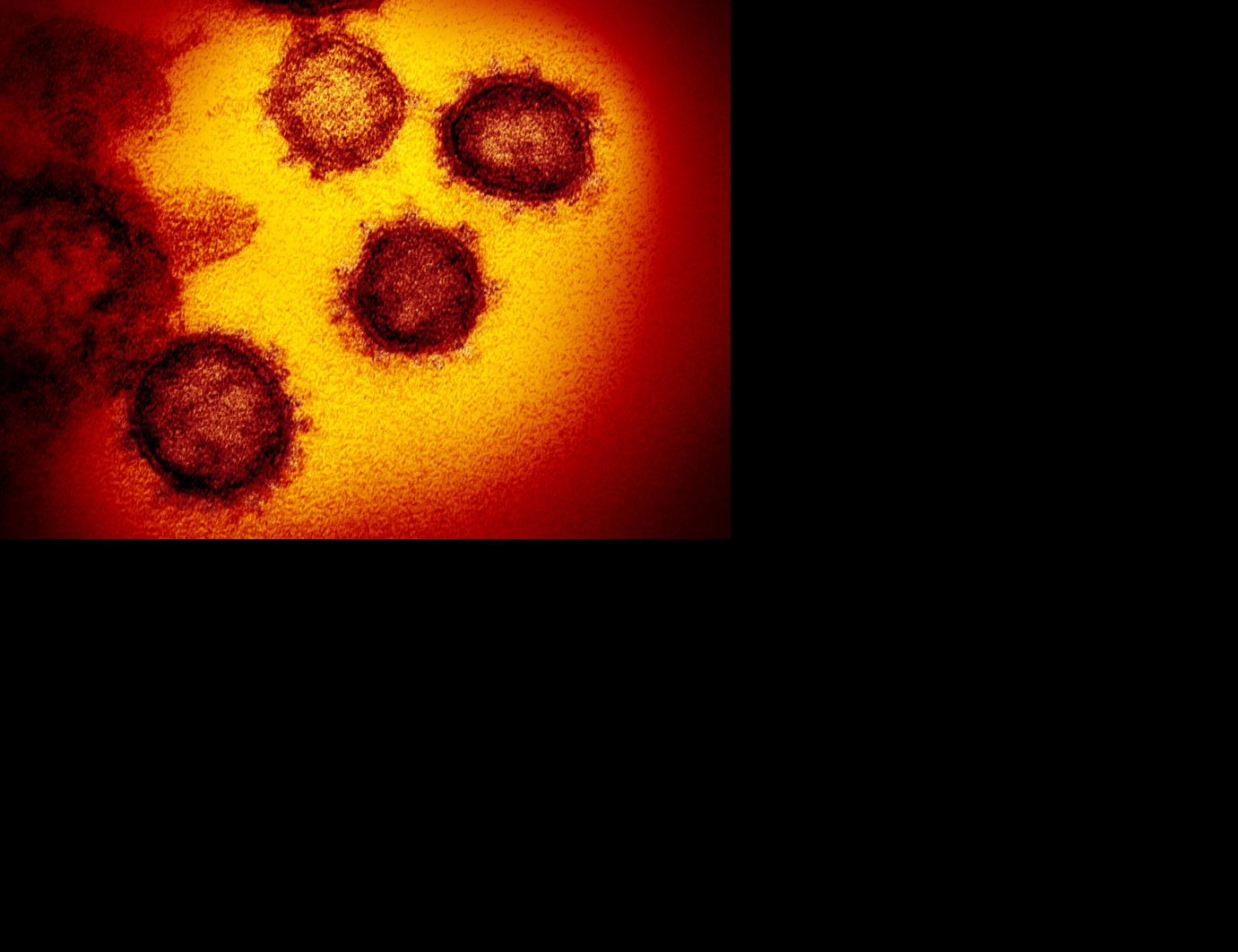 Coronavirus SC cases are underreported as DHEC struggles with internal systems problem |  COVID-19