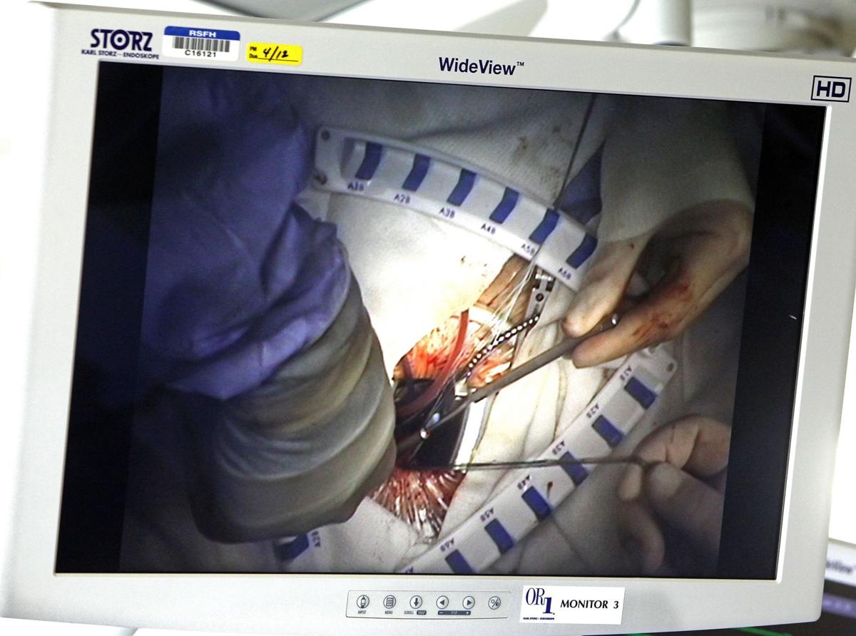 Heart Surgery