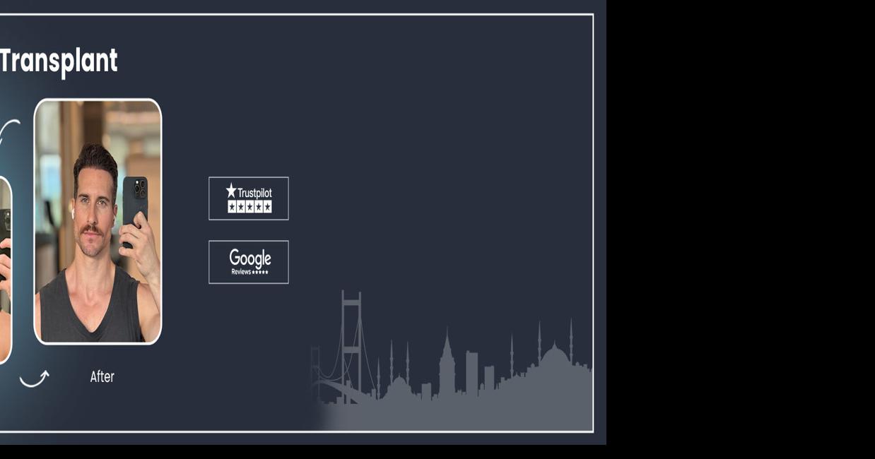 Top 10 Best Hair Transplant Clinics in Istanbul, Turkey for 2026 – Last Update