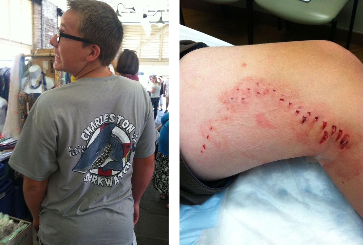 12 Year Old Treated Tuesday For Minor Shark Bite At Isle Of Palms County Park Archives Postandcourier Com