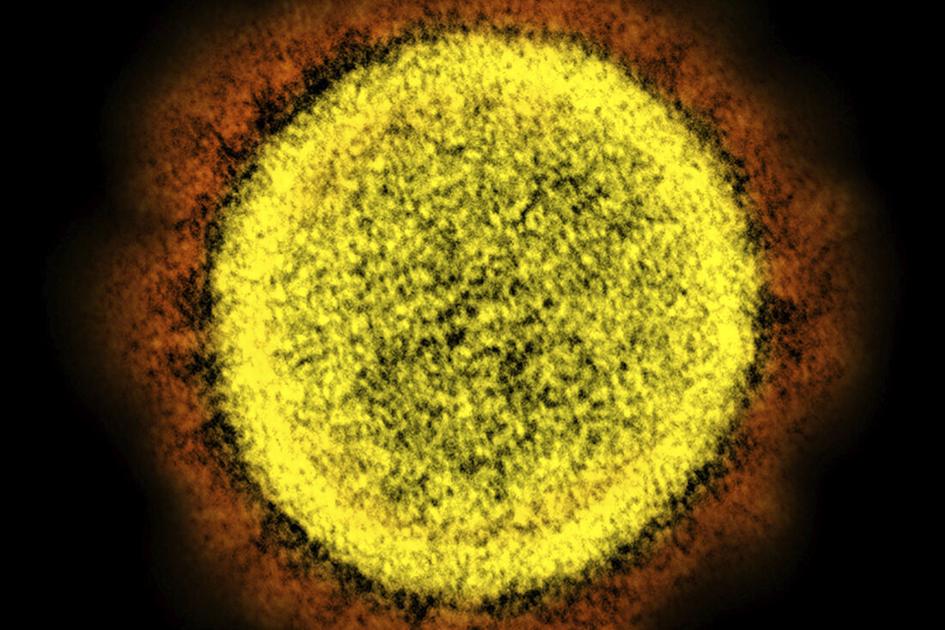 More than a third of SC coronavirus tests are positive, as the state reports 51 more deaths |  COVID-19